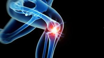 成人有滑膜炎吗视频,常见症状与防治策略