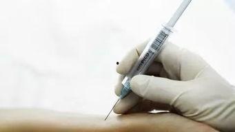 成人动脉采血教学视频,动脉采血操作技巧与要点解析